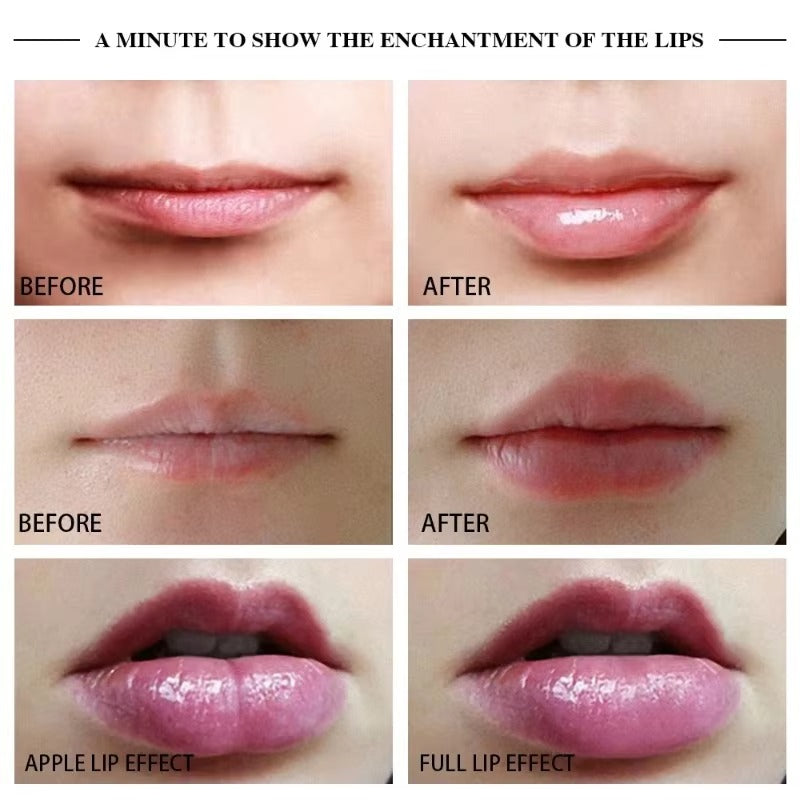 Electric Lip Enhancer